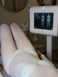 LPG  : Cellulite , ventre , rétention d'eau : et si c'était le moment de dire stop ?  
