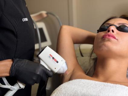 Epilation laser: pourquoi l'automne est le moment idéal pour commencer.